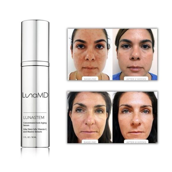NEW LunaMD Lunastem Anti Aging Serum Face & Neck Moisturizer Hydration Wrinkles - Picture 4 of 16